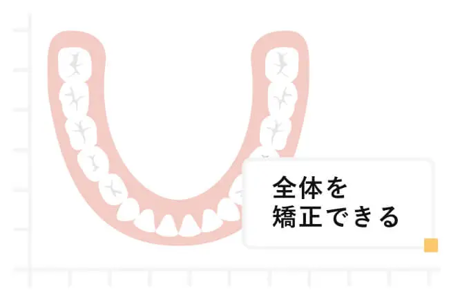 前歯から奥歯まで全体を矯正できる