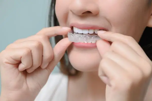 マウスピース矯正で歯が動かない?どうしたら動く?原因と対処法を解説!