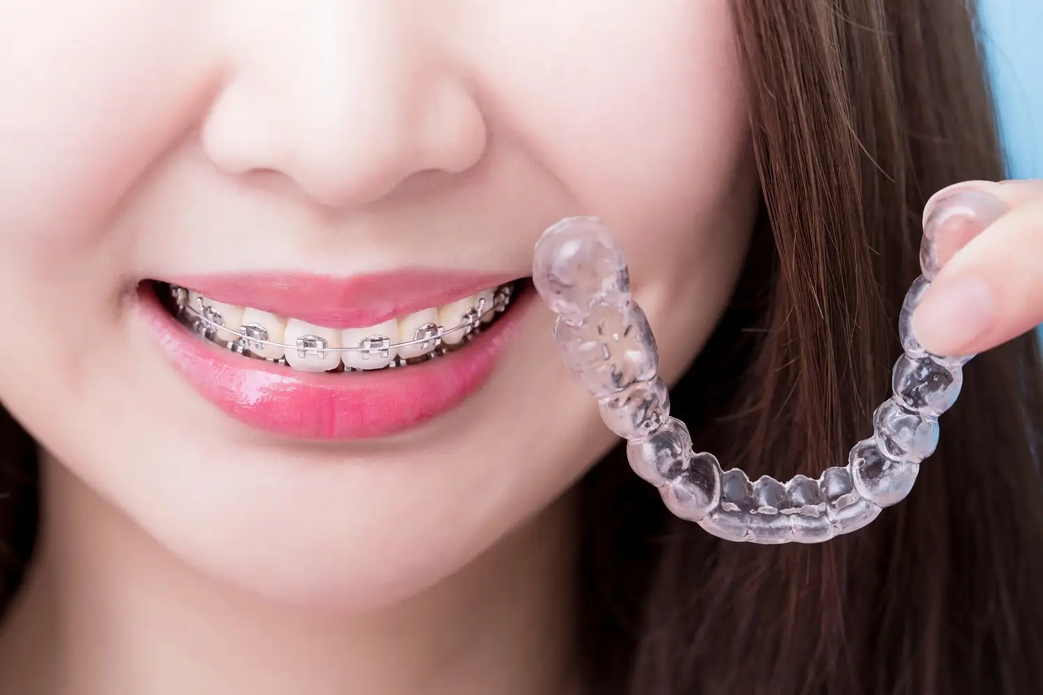 歯 列 矯正 仕事 へ の 影響